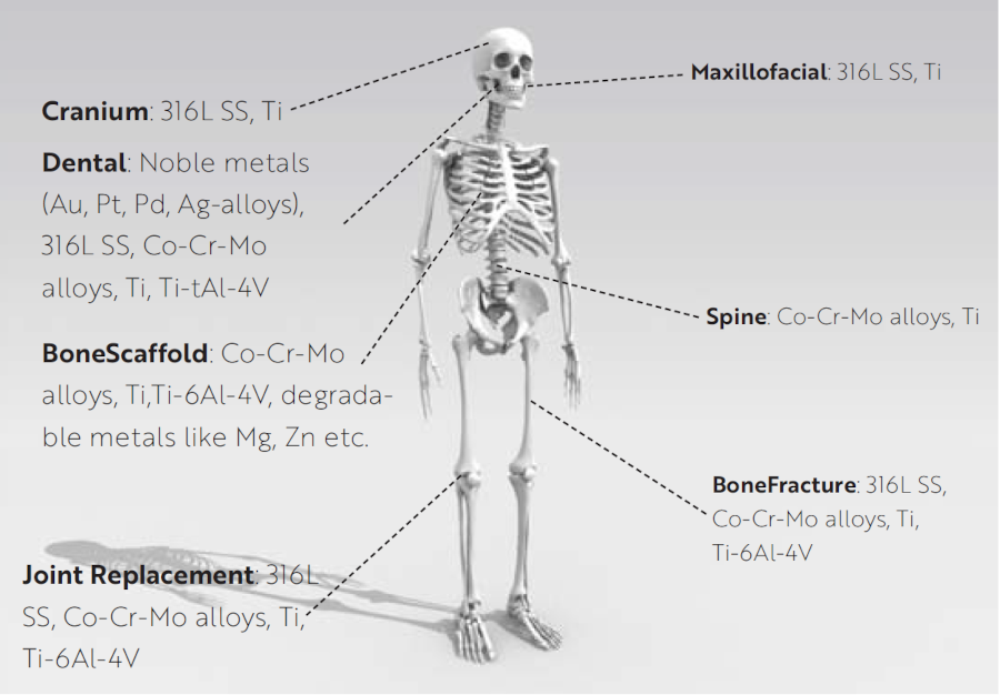 bild-adw-orthopaedics-3-k Edelstahl 316L, ideal für orthopädische chirurgische Implantate